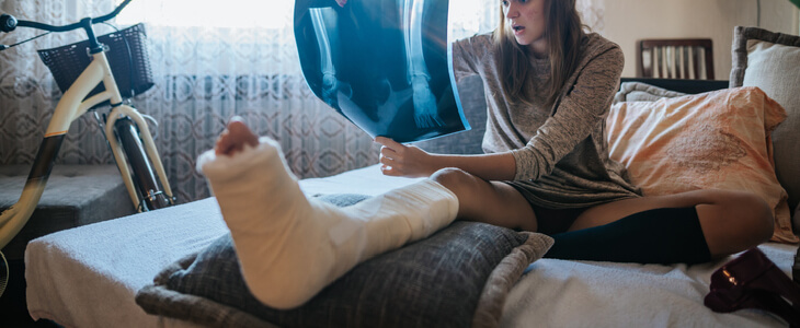 A girl sitting at home with broken bones in her leg