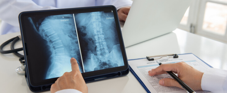 Doctors analyzing and pointing to an x-ray of the spinal cord, indicating paralysis or a spinal cord injury