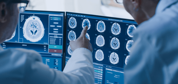 Doctors looking at scans of a brain injury after the person received an MRI