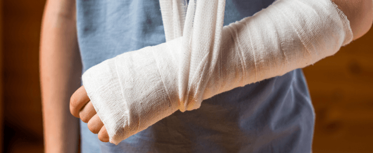 Broken arm on a child after a personal injury accident